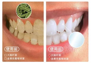 口腔清潔新革命 3秒去除口臭，連打嗝都是薄荷清香