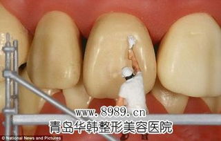 超聲波洗牙與牙膏的功效對比分析